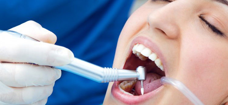 Root-Canal-Therapy-Single